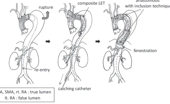 Fig. 1  Schematic drawing of case 1.