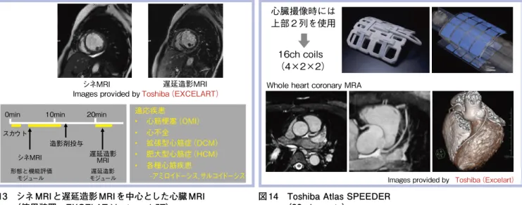 図 13　 シネ MRI と遅延造影 MRI を中心とした心臓 MRI 
