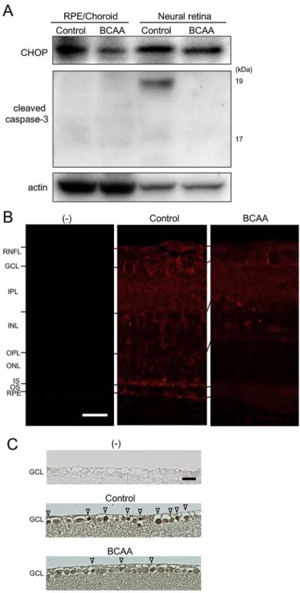 Fig. 9. Suppression of ER stress by BCAAs leads to suppression of cleaved caspase-3 in mouse models