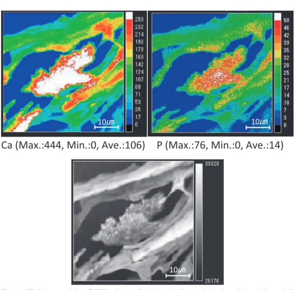 Fig. 4. SEM  image  of  the β-TCP/collagen.  Color  bars  indicate  relative  intensities  of  Ca  and  P  measured  by  EPMA