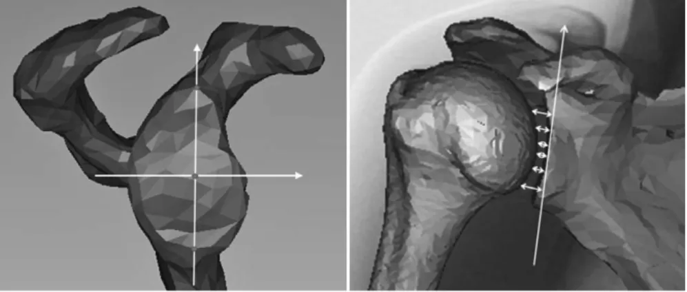 Fig. 3.  （a.）   The  glenoid  center  was  defined  as  the  midpoint  of  the  long  axis