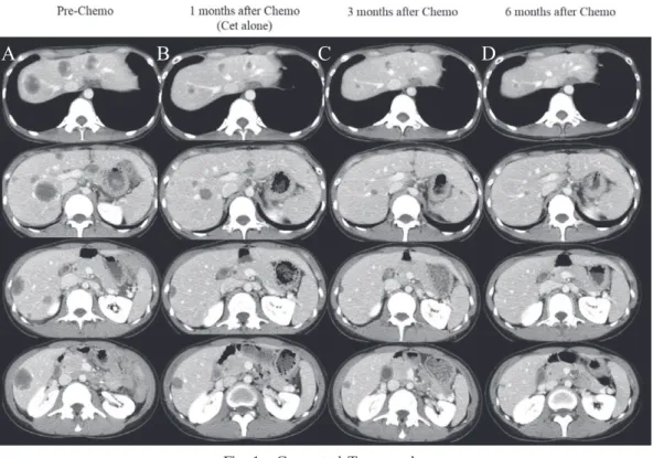 Fig. 1.  Computed  Tomography