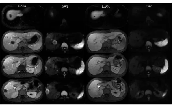 Fig. 2.  Magnetic  Resonance  Imaging