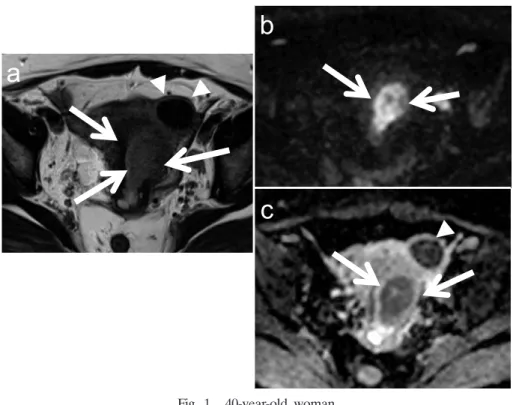 Fig. 1.  40-year-old  woman