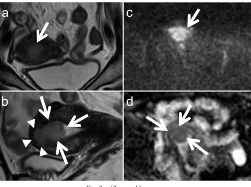 Fig. 2.  62-year-old  woman