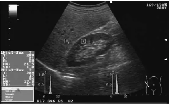 Fig. 1.  Sonogram  of  the  liver  and  right  kidney.    The  histogram  shows  the  frequency  distribution  of  the  gradients  included  in  the  ROI  that  are  placed  in  the  liver  or  the  right  renal  cortex.