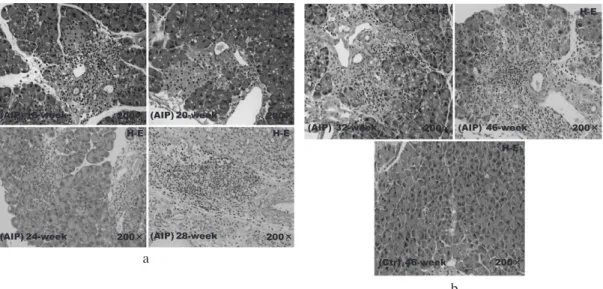 Fig. 3.  Histological  changes  in  the  pancreatic  tissue  of  aly/aly  mice  as  a  model  of  autoimmune  pancreatitis 