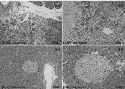 Fig. 5.  Histological  changes  in  the  pancreatic  tissue  of  aly/aly  mice  as  a  model  of  autoimmune  pancreatitis  （AIP）   and  aly/+ （control）   mice 