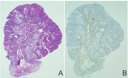 Fig.  1. Low-power  view  of  the  polyp（original  magnification,  1.25）