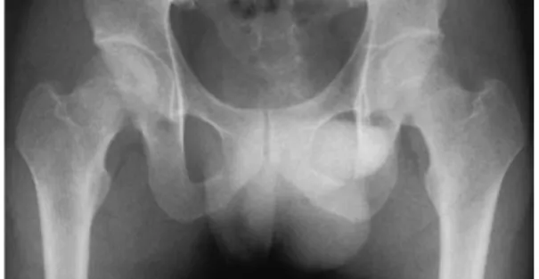 図 2 初診時単純 CT 像