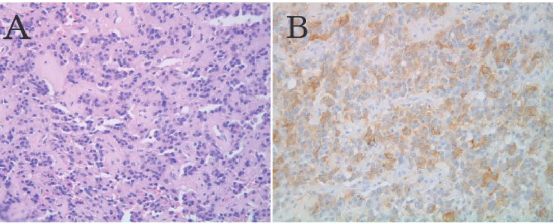 Fig.  2 Tumor cell isolation by laser microdissection.