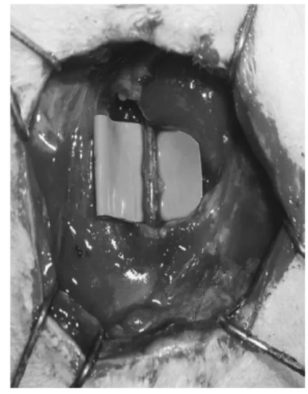 Fig.  3  Collection  of  samples  at  the  vascular  anasto- anasto-motic sites.