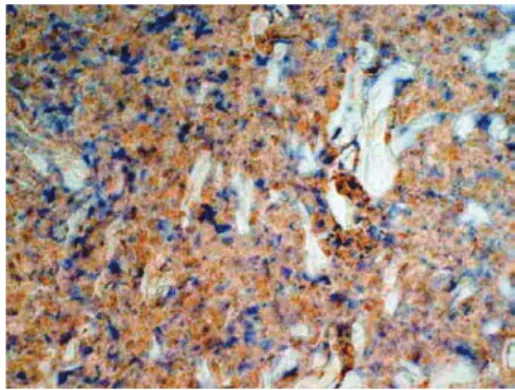Table  2  The number of cells responding after staining  for bFGF.