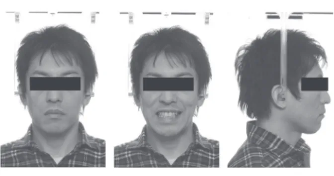 Fig. 8   Treatment results.
