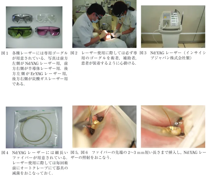 図 4  Nd:YAG レ ー ザ ー に は 細 長 い ファイバーが用意されている． レーザー使用に際しては毎回術 前にオートクレーブにて器具の 滅菌をおこなっておく． 図 5 ， 図 6  ファイバーの先端の 2 〜 3 ｍｍ短い長さまで挿入し， Nd:YAG レーザーの照射をおこなう．図1  各種レーザーには専用ゴーグルが用意されている．写真は前方左側がNd:YAGレーザー用，前方右側が半導体レーザー用．後方 左 側 がEr:YAGレ ー ザ ー 用，後方右側が炭酸ガスレーザー用である．図3  Nd