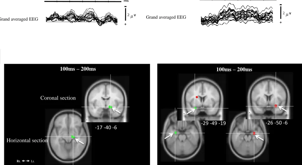 Figure 3  100ms – 200ms Horizontal section  -17 -40 -6  100ms – 200ms  -26 -50 -6 -29 -49 -19 2 2  μ μ  v  v + + 2 μ μ v v + + 0 0 - - 100 100 100 100 200 200 300 300 400 400 ms 0 ms - 0 - 100 100 100 100 200 200 300 300 400 400 ms A ms B 