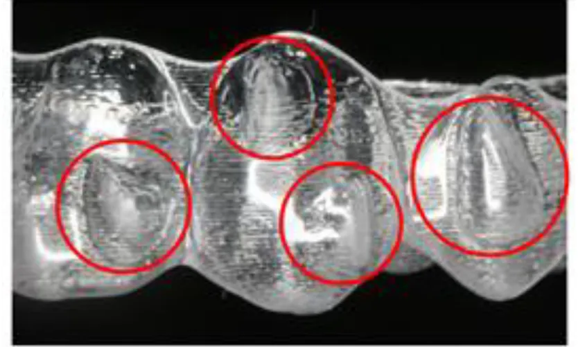 Fig. 1 Aligner with attachments 