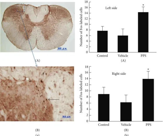 Figure 1: (a-A) Photomicrograph of c-Fos expression in the C2 spinal segment of a PPS-infused rat