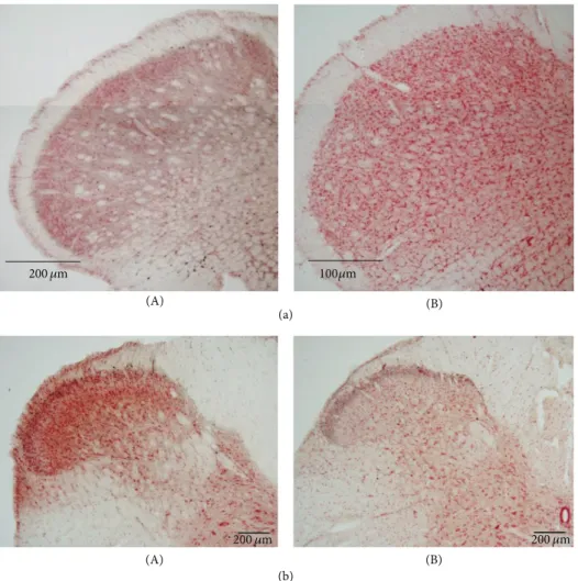 Figure 5: Effects of vagotomy on c-Fos expression in PPS-infused rats. The cervical vagus nerve was bilaterally sectioned