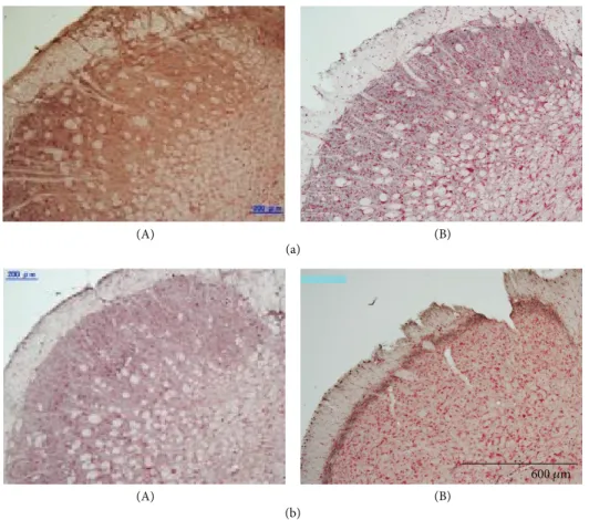 Figure 7: Effects of the lesion of the C1-C2 spinal segments on c-Fos expression in vehicle-infused (a) and PPS-infused (b) rats.