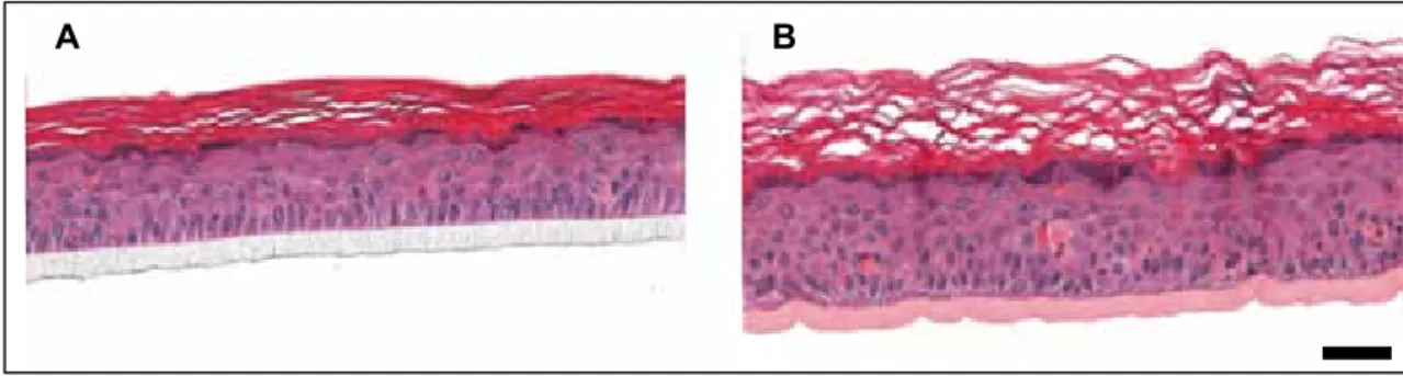 Figure 2:  Comparison of RHE generated on track-etched membranes (A) and the vitrigel  collagen membrane (B)
