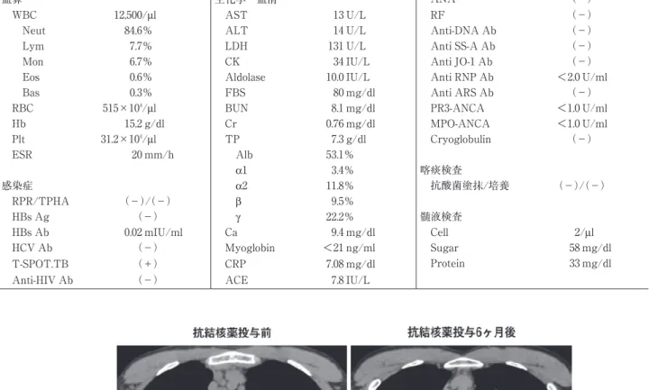 図 1 胸部単純 CT 画像