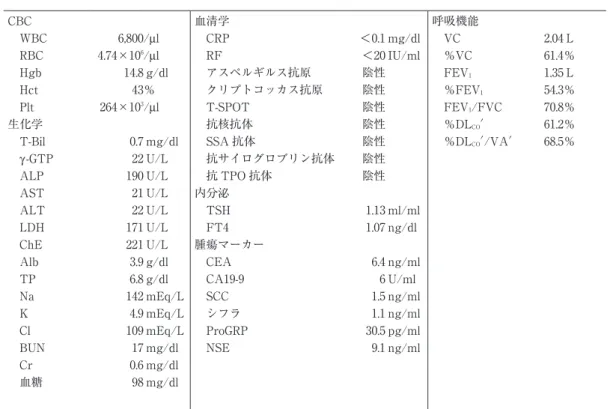 図 1 （A）胸部 X 線写真．右肺に巨大気腫性ブラを認める．（B）胸部 CT．右 肺中葉に 29×18 mm の結節影を認める（矢印）． 図 2 （A）手術で摘出した右肺中葉．肥厚した肺胞壁に単調な小型〜中型のリンパ球が増殖している［hematoxylin-eosin （HE）染色，×4］．（B）単調な小型〜中型のリンパ球が気管支上皮内に浸潤し，lymphoepithelial lesion を形成している （HE 染色，×40）．（C）リンパ球は CD20 に陽性で B 細胞性である（免疫染色，×20）