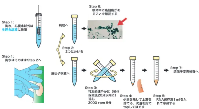 図 2 遺伝子変異検査用臨床サンプルの採取法．DNA と RNA の同時検索が可能な手法である．RNA は分解しやすく，採取時 の不適切な手技により容易に分解する．良好な RNA を採取可能なサンプルを保存することは，臨床医の重要な責任になる だろう．