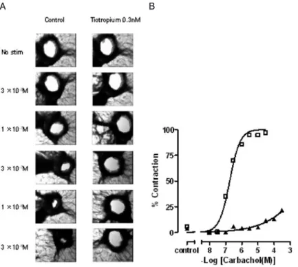 図 4 ヒト末梢気道における気道収縮反応および tiotropium の効果．ヒト末梢気 道を含んだ PCLS をメディアまたは 0.3 nM tiotropium とともに 90 分間培養後 carbachol で低濃度より刺激した．（A）メディアまたは 0.3 nM tiotropium で処 理したヒト末梢気道の carbachol に対する気道収縮反応の代表的な画像．（B） メディア（□）または 0.3 nM tiotropium（▲）で処理したヒト末梢気道の  car-bachol に対する代表的