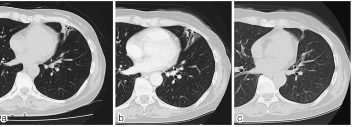 Fig. 6. Chest CT images (a) First visit