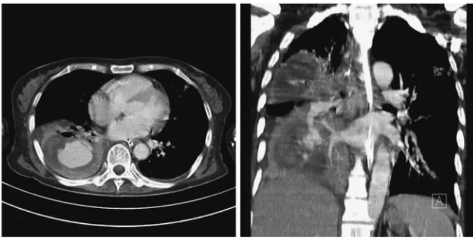 Fig. 11. Contrast-enhanced chest CT images