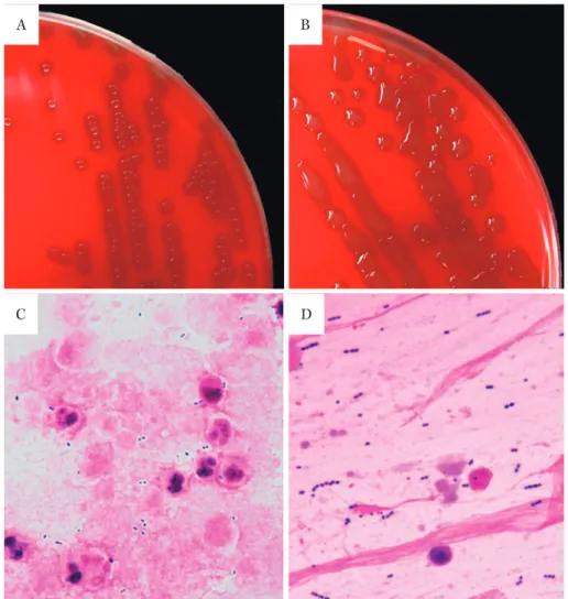 Fig. 1. Distinction between non-mucoid type S. pneumoniae and mucoid type S. pneumoniae.