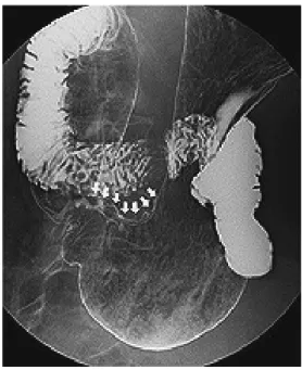 Fig. 1. Fluoroscopy examination.