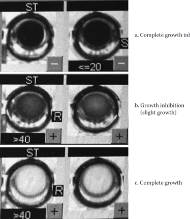 Fig. 1. Growth patterns of  Stenotrophomonas maltophilia  in the broth micro- micro-dilution method.