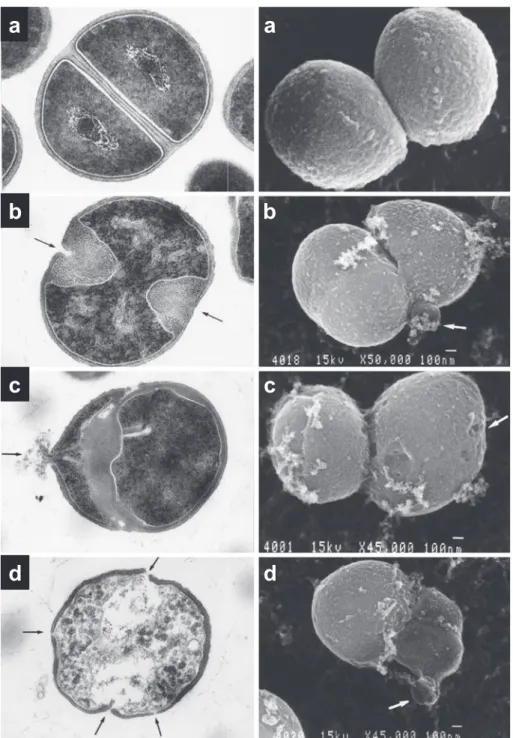 Fig. 7. Transmission (left) and scanning (right) electron micrographs of S. aureus 209-P JC cells  treated with cefotiam (CTM).