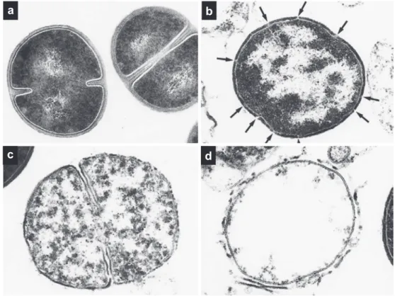 Fig. 8. Ultrathin sections of S. aureus 209-P cells exposed to FOM. 