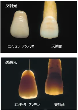 図 5 エンデュラ アンテリオと天然歯のオパール効果エンデュラ アンテリオ天然歯反射光透過光エンデュラ アンテリオ天然歯    の選択及び成型方法から検討した。三層構    造の断面図を図 4 に示す。    ③ 機能性・審美性について      天然歯はハイドロキシアパタイトの構造     により反射光では白く、透過光では赤褐色     となるオパール効果を持っている。エンデ     ュラエナメル部の超微粒子フィラーを含む     構造は、天然歯と同じようにアクリル系レ     ジン歯には見られないオパー