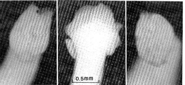 Figure 2 Scolex of specimen No. I : dorsoventral view (left), Iateral view (middle), and apic'al view (right). 