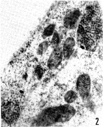 Figure 2  Figure 3A  <***i.1"+; "*  <* *,, i:iii:; +"  :*::.i'+*   ** =* ,+ .***  ;*'+ .:  
