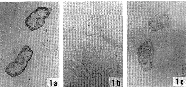 Figure 1 Immunostaining of P. ohirai NEM sections. Sections were treated with the  monoclonal antibodies MS‑Mab (a) or AS‑Mab (b), or with normal mouse  serum (c). The surface syncytium, the tegumental cells, and the ventral  sucker were stained by MS‑Mab,