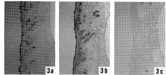 Figure 3  Immunostaining of sections of adult P, ohirai fluke8 obtained from the lung8  Of infected rats. Sections were treated with the monoclonai antibodies MS‑ Mab (a) or AS‑Mab (b), or with normal mouse serum (c'.). The surface  syncytium and the tegum