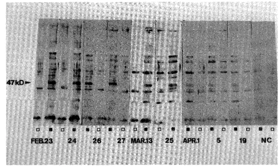 Figure I Two months observation on the P.f 47kD antigenic polypeptide prcsented  by the sera taken from a Japanese falciparum case,  (1: P.f antigenic polypeptide, [li: RBC antigenic polypeptide, NC: serum  from a healthy donor)  reactivity against the 47k