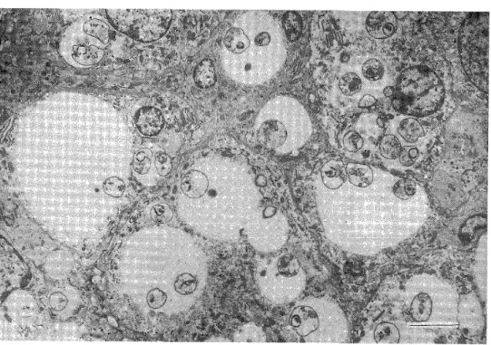 Figure 9  Electron micrograph of the section frcu n the nose. Parasites are in various  stages o･f degeneration. bar=5 ;Im  ** ･ {  =>='  /** {:  : "'. .
