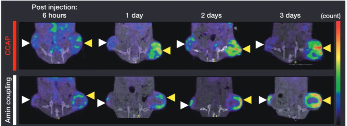 Fig. 2 SPECT images of different HER2 expression tumors All images display on coronal slice images and an optimal scale.
