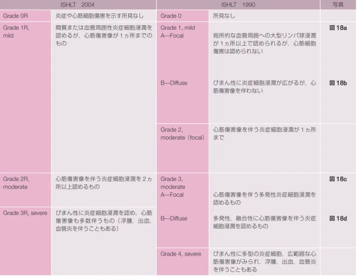 表 16  ISHLT による急性細胞性拒絶反応（ACR）の分類 ISHLT 2004 ISHLT 1990 写真 Grade 0R 炎症や心筋細胞傷害を示す所見なし Grade 0 所見なし Grade 1R,  mild 間質または血管周囲性炎症細胞浸潤を 認めるが，心筋傷害像が 1ヵ所までの もの Grade 1, mildA̶Focal B̶Diffuse 局所的な血管周囲への大型リンパ球浸潤が1ヵ所以上で認められるが，心筋細胞傷害は認められないびまん性に炎症細胞浸潤が広がるが，心 筋傷害像を伴わな
