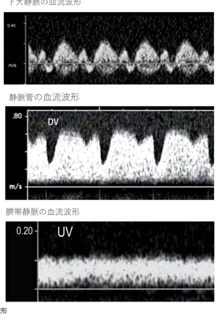 図 18   Preload Index （ a/S 比）