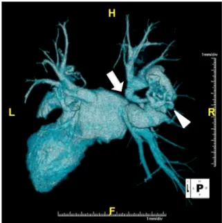 Fig.   2   Contrast-enhanced 3D-CT