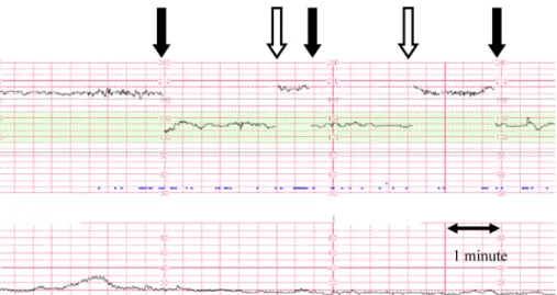 Table   1   Cardiovascular Proﬁle Scoring System 4 ）