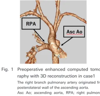 Fig.   1  Preoperative enhanced computed tomog- tomog-raphy with 3D reconstruction in case1