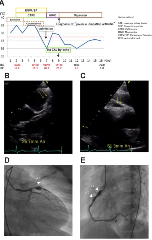 Fig.   2   Clinical course and echocardiographic and angiographic ﬁndings in Case 2